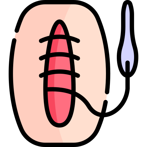 suture